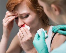 Woman with nosebleed.