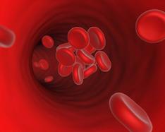 Thrombosis Blood Clots Richard T. Silver MD Myeloproliferative